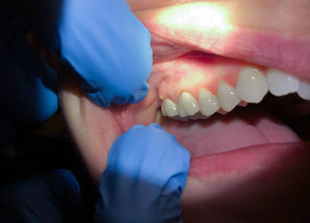  California, MO Emergency Dentist Pros