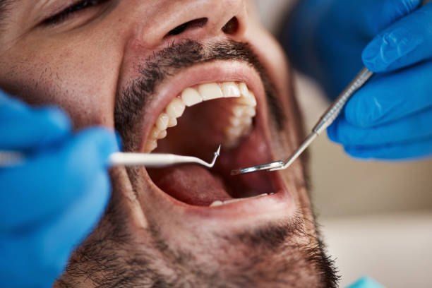 Best Broken or Cracked Tooth Emergency Dentist in California, MO